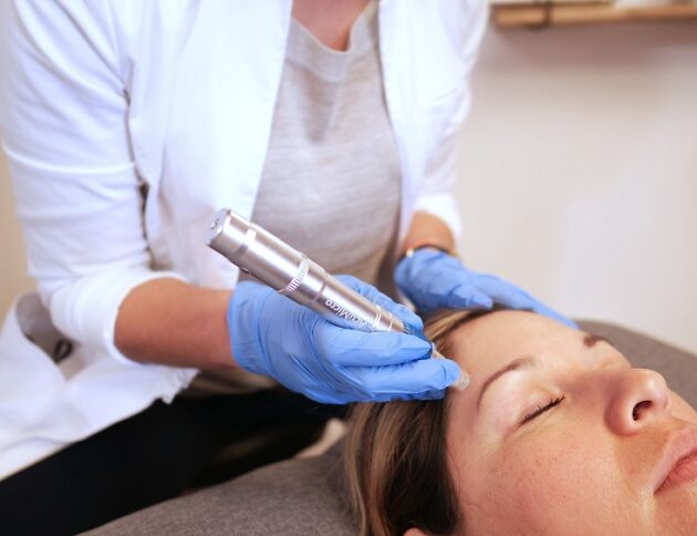 acupuncture acupuncture